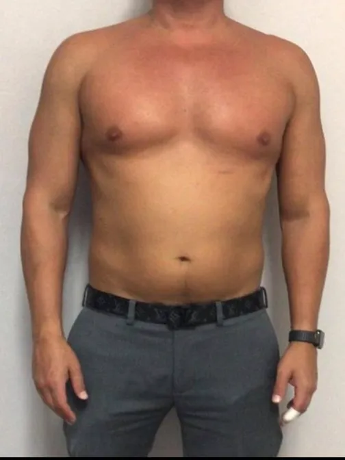 Before