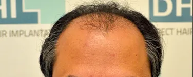 Before