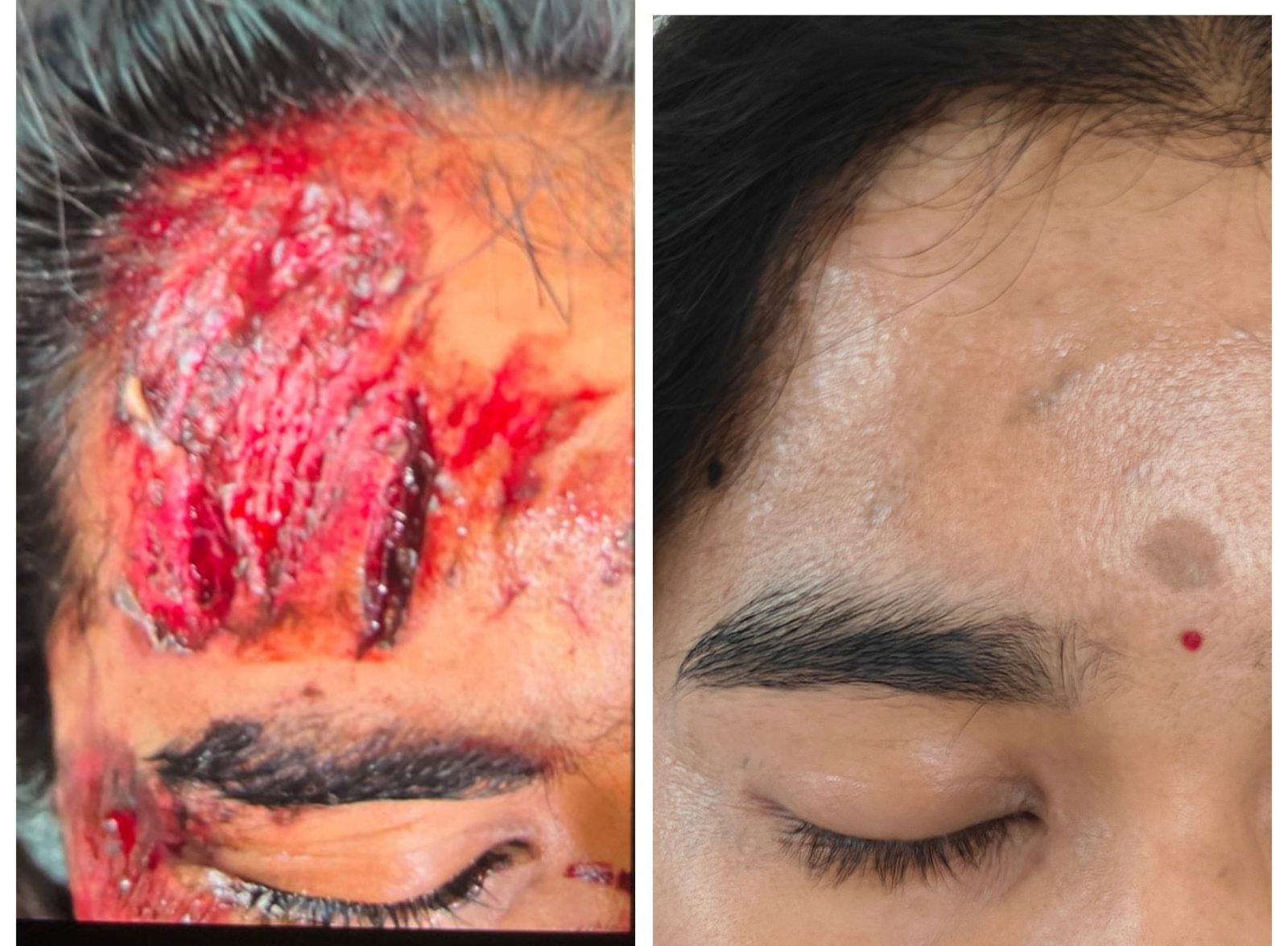Trauma Reconstruction